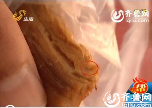 最新挤寄生虫视频合集