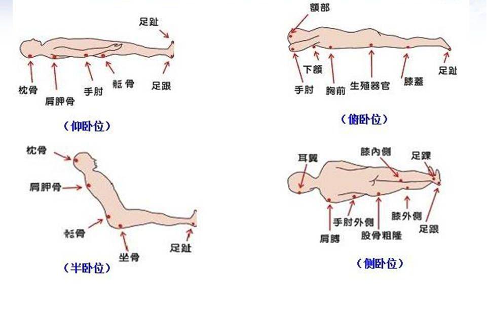 第170页